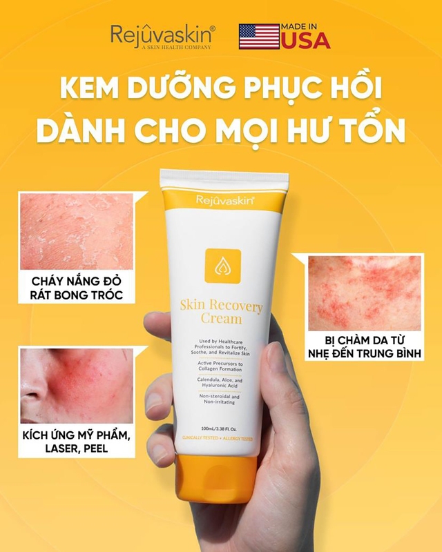 Những yếu tố duy trì làn da nhạy cảm khỏe mạnh - Ảnh 5.