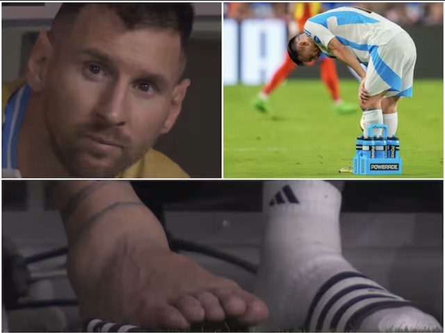 Tiết lộ chấn thương của Messi, khi nào trở lại thi đấu?- Ảnh 2.