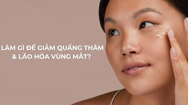 Làm gì để giảm quầng thâm và lão hóa vùng mắt?- Ảnh 1.