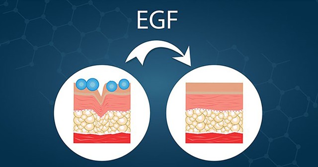 Yếu tố tăng trưởng EGF là gì? Tại sao được ứng dụng để chống lão hóa da?- Ảnh 2.