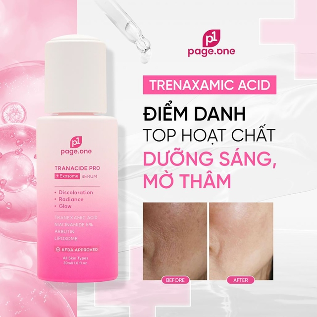 Vì sao chọn Tranexamic Acid trong điều trị nám, tăng sắc tố sau viêm?- Ảnh 1.