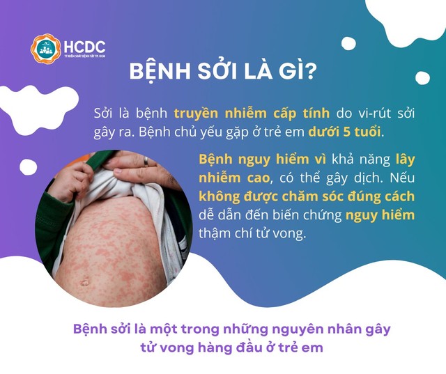 Vì sao Sở Y tế kiến nghị UBND TP.HCM công bố dịch sởi?- Ảnh 2.