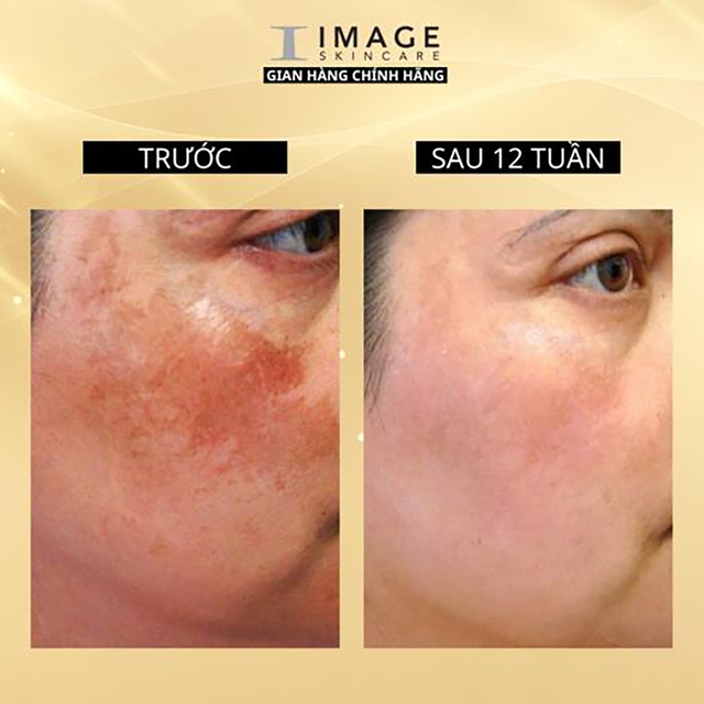 Review kem dưỡng trắng da Image Skincare có tốt không và top 3 được tìm mua nhiều- Ảnh 11.