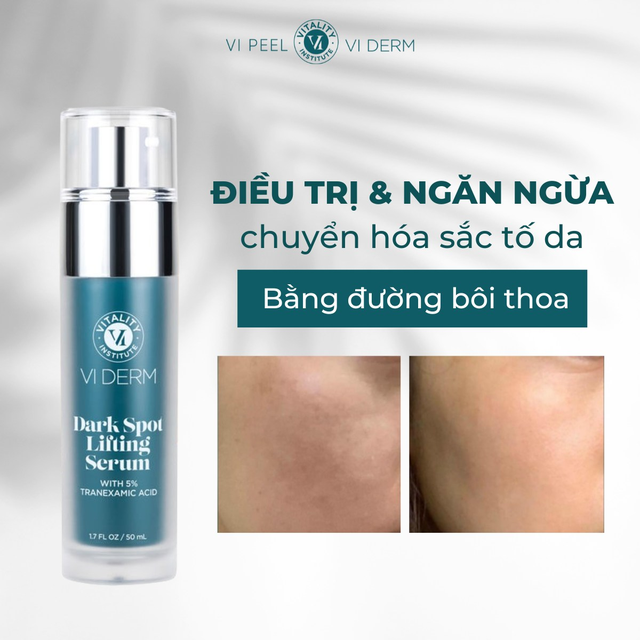 Top 8 sản phẩm Niacinamide trị nám tận gốc cho làn da trắng hồng rạng rỡ- Ảnh 9.