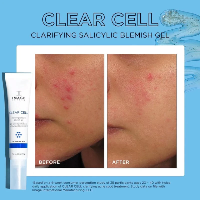 Gel chấm mụn Image Clear Cell Clarifying Salicylic Blemish Gel - Dr.Da liễu  của bạn