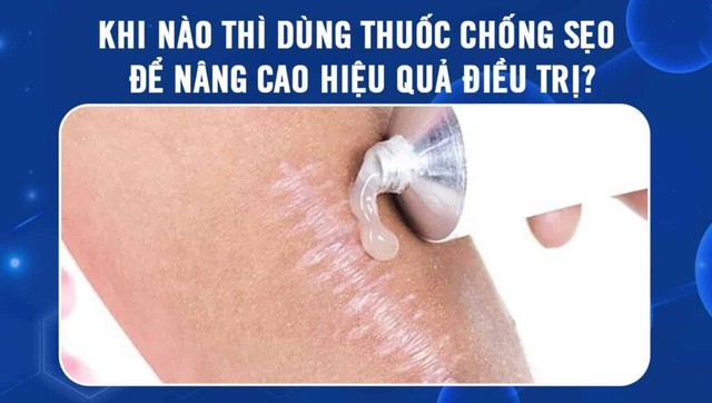 Hướng dẫn cách sử dụng thuốc trị sẹo hiệu quả tận gốc mà không gây kích ứng- Ảnh 2.