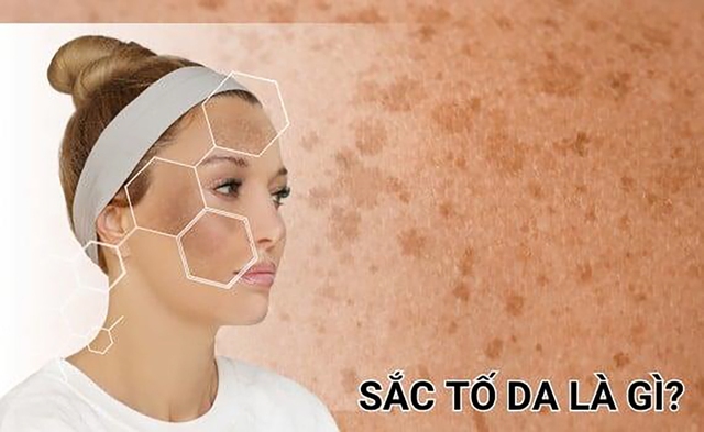 Tăng sắc tố da và 3 serum trị nám hiệu quả tại nhà không cần xâm lấn- Ảnh 1.