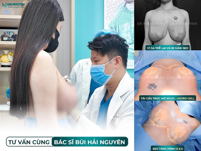 Thảm họa ‘treo ngực chui’ và những hậu quả khôn lường- Ảnh 4.