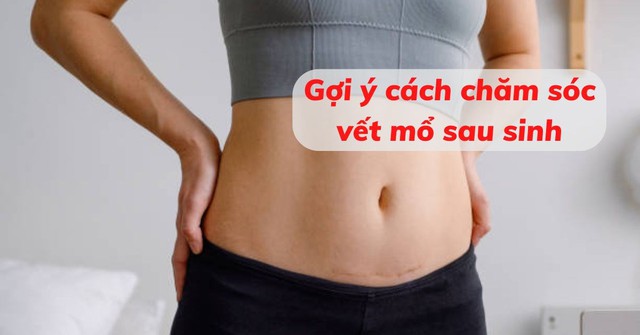 Mách mẹ cách chăm sóc vết mổ sau sinh nhanh lành và không để lại sẹo- Ảnh 1.