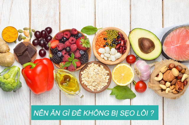 Sẹo lồi ngứa nguyên nhân do đâu? Cách điều trị sẹo lồi hiệu quả ngay tại nhà- Ảnh 8.