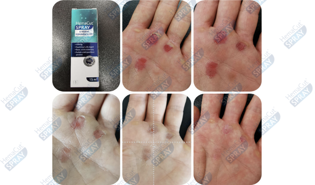 3 mẹo giúp bạn bảo vệ làn da ngay trong căn bếp- Ảnh 3. 3 mẹo giúp bạn bảo vệ làn da ngay trong căn bếp- Ảnh 3.