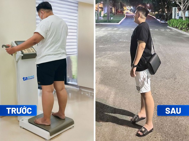 Anh Dân (người Campuchia) đã giảm 22kg, hết gan nhiễm mỡ sau khi điều trị tại Trung tâm Giảm cân Tâm Anh. Ảnh: BVĐK Tâm Anh