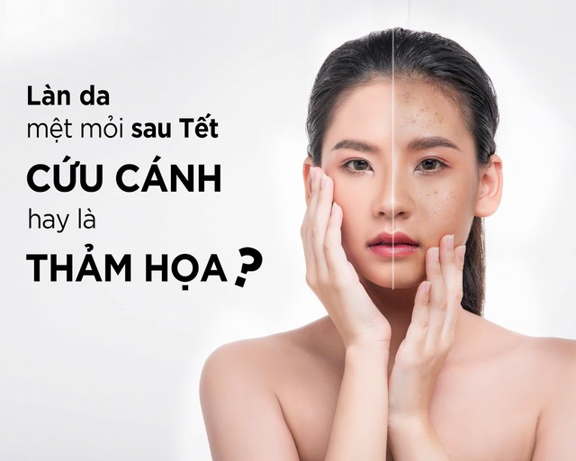 Làn da mệt mỏi sau Tết: Cứu cánh hay là thảm họa? - Ảnh 1.