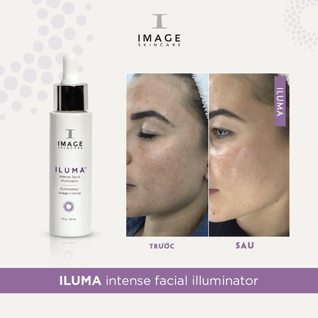 Review serum Image Iluma Intense Facial Illuminator có hiệu quả trị nám trong 4 tuần không?- Ảnh 1.