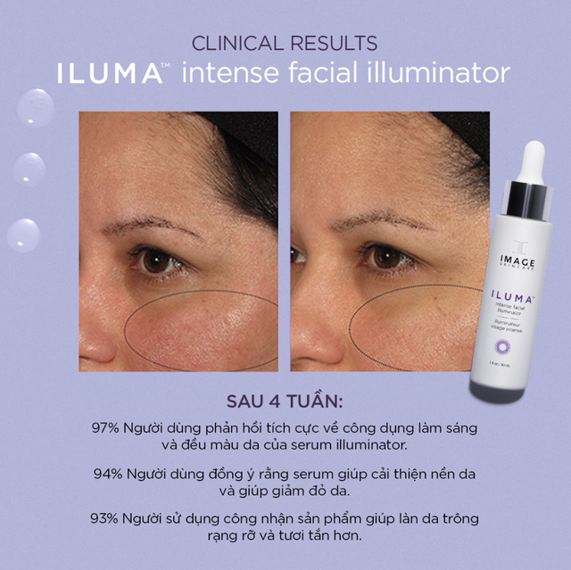 Review serum Image Iluma Intense Facial Illuminator có hiệu quả trị nám trong 4 tuần không?- Ảnh 3.