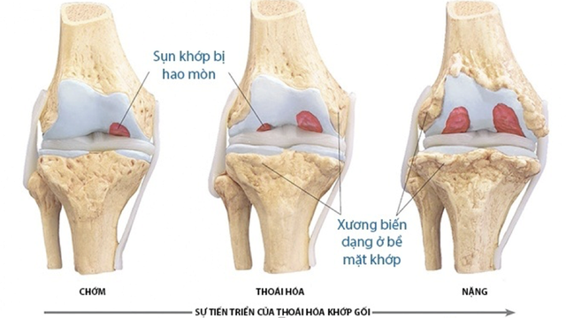 Collagen thủy phân là gì? Đâu là loại tốt và được tìm mua nhiều?- Ảnh 4.