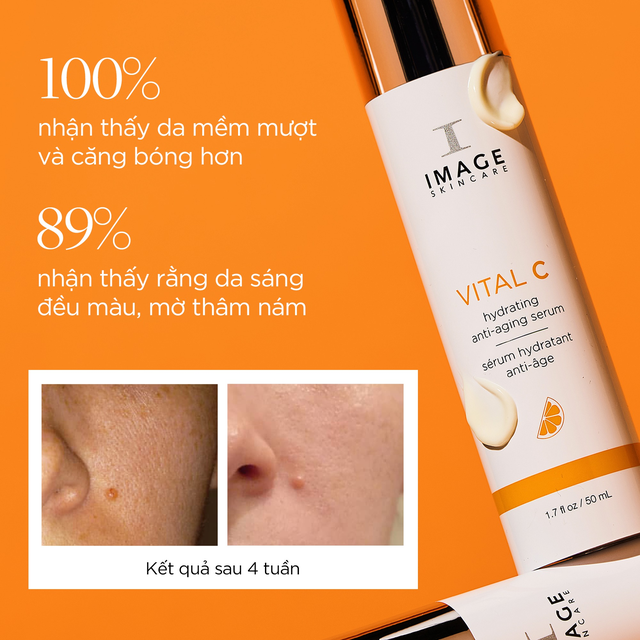 Review serum cấp ẩm, chống lão hóa Image Vital C Hydrating Anti-Aging có hiệu quả 4 tuần?- Ảnh 5.