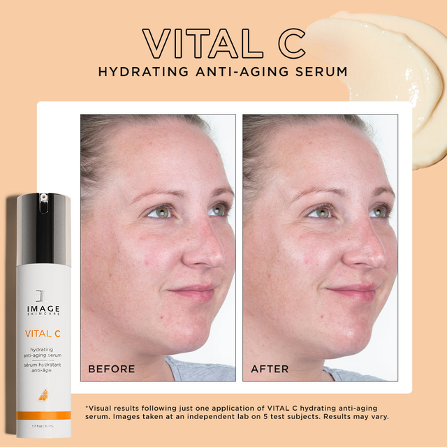 Review serum cấp ẩm, chống lão hóa Image Vital C Hydrating Anti-Aging có hiệu quả 4 tuần?- Ảnh 10.