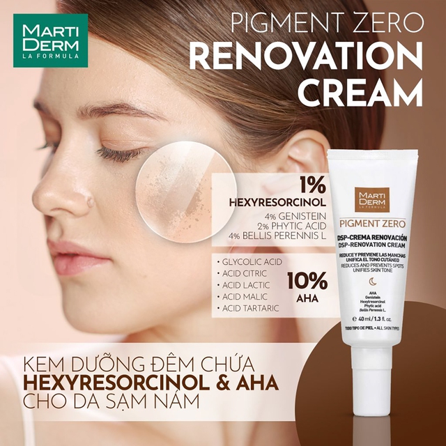 Top 10 kem dưỡng da trị nám, tàn nhang hiệu quả trong 4 tuần- Ảnh 2.