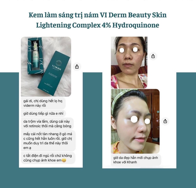 Top 10 kem dưỡng da trị nám, tàn nhang hiệu quả trong 4 tuần- Ảnh 7.