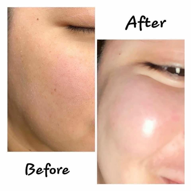 Top 10 serum dưỡng ẩm cho làn da căng mịn, tràn đầy sức sống như tiêm botox- Ảnh 7.