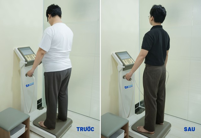 Khách hàng giảm 22kg sau 10 tháng điều trị tại Trung tâm Giảm cân Tâm Anh. ẢNH: BVĐK TÂM ANH