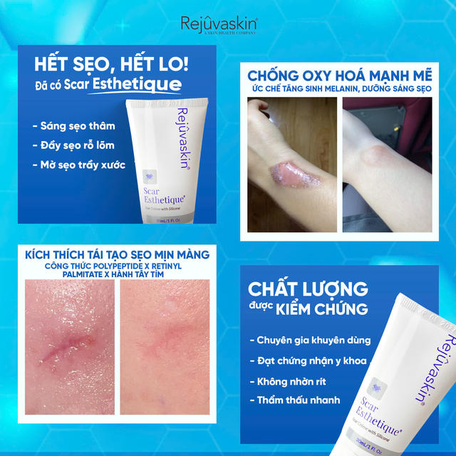 Sẹo kh&ocirc;ng chỉ ảnh hưởng thẩm mỹ m&agrave; c&ograve;n sức khỏe tinh thần- Ảnh 5.