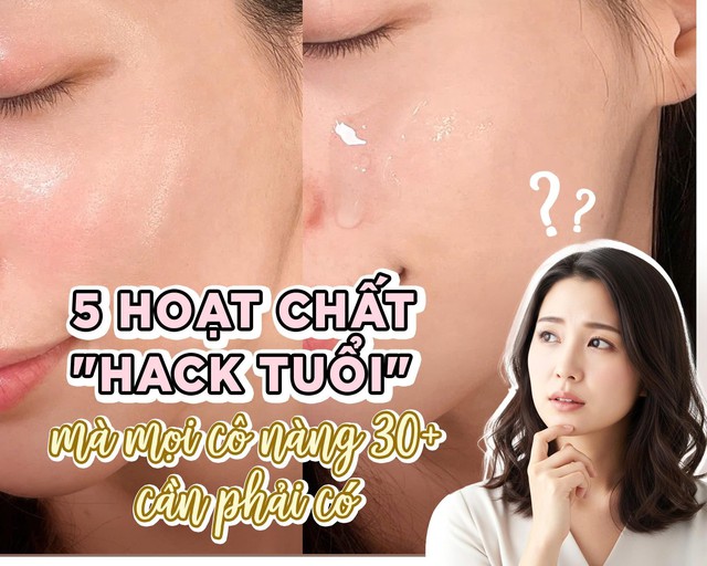 List 5 hoạt chất ‘hack tuổi’ mà mọi cô nàng 30+ cần phải có trong routine - Ảnh 1.