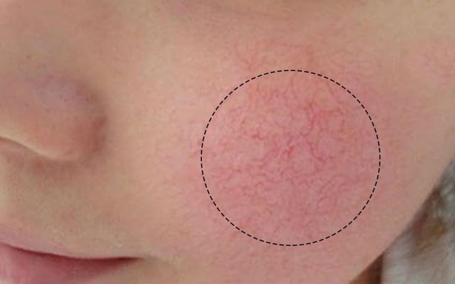 Phân biệt kem mờ sẹo Rejuvaskin Scar Esthetique thật giả chuẩn xác nhờ 4 yếu tố - Ảnh 2.