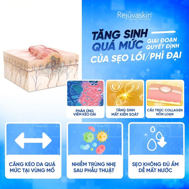 Cuộc chiến với sẹo: Nắm &lsquo;vũ kh&iacute;&rsquo; khoa học chống sẹo sau phẫu thuật- Ảnh 2.