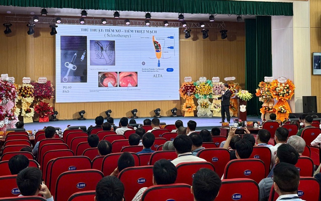 Điều trị bệnh trĩ không phẫu thuật - Ảnh 1.