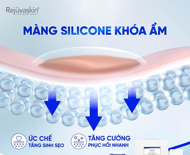 [Review nhanh] Top 5 c&aacute;ch trị sẹo lồi đang được thực hiện nhiều hiện nay- Ảnh 4.