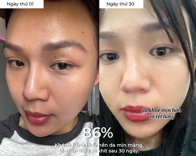 97% phụ nữ bổ sung collagen đ&uacute;ng c&aacute;ch da căng s&aacute;ng trẻ hơn chục tuổi l&agrave; thật!- Ảnh 1.