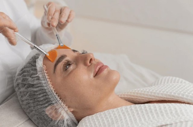 Da đỏ r&aacute;t sau peel/tretinol - cơ chế phục hồi khoa học- Ảnh 1.