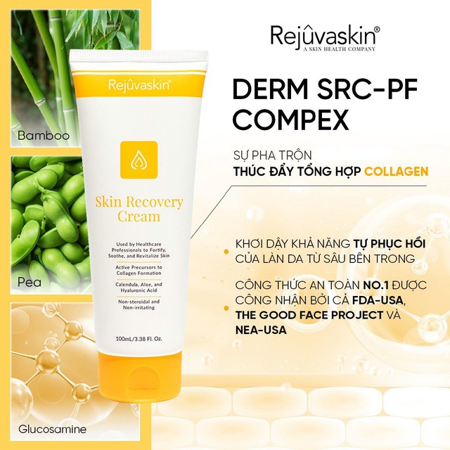 Da đỏ r&aacute;t sau peel/tretinol - cơ chế phục hồi khoa học- Ảnh 3.