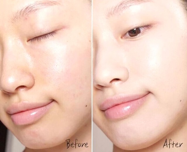 Top 8 serum trắng da đáng tiền từng giọt, mua rồi muốn mua nữa không tiếc tiền - Ảnh 1.