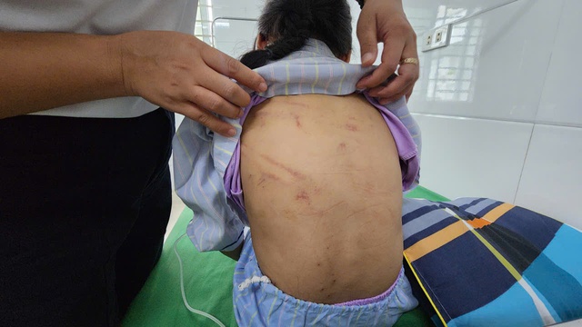 Vụ bé gái ở Hà Tĩnh bị bạo hành: Bắt giữ người cha dượng- Ảnh 2.