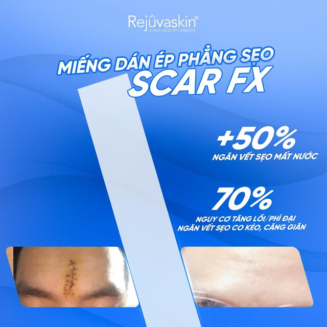 Silicone y tế: Ph&ograve;ng th&iacute; nghiệm đến ph&ograve;ng mổ - H&agrave;nh tr&igrave;nh c&ocirc;ng nghệ kiểm so&aacute;t sẹo   - Ảnh 4.