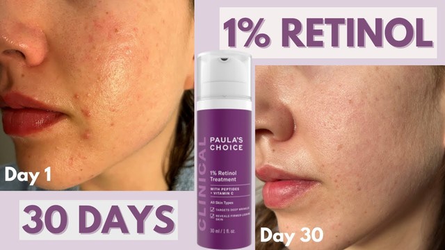 Top 3 Retinol gi&uacute;p l&agrave;n da từ 35+ &lsquo;quay ngược thời gian&rsquo; căng trẻ như tuổi 20 - Ảnh 5.
