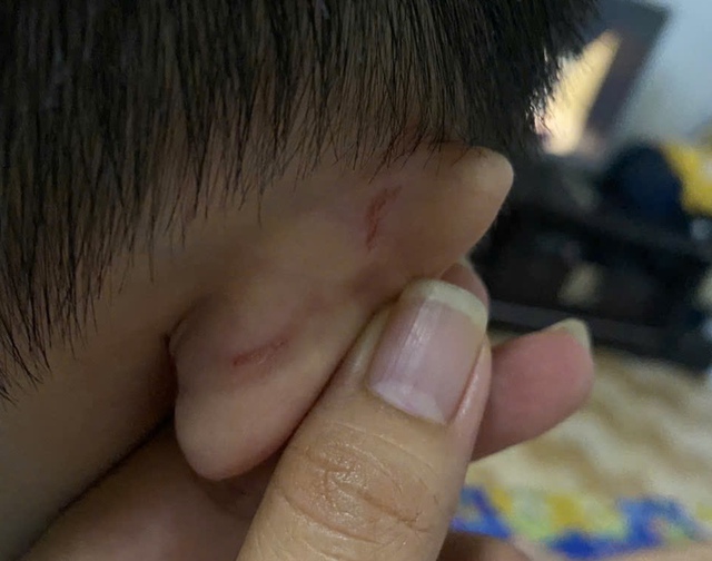 Phụ huynh tố giáo viên bạo hành trẻ, yêu cầu bồi thường 1 năm học phí - Ảnh 2. Phụ huynh tố giáo viên bạo hành trẻ, yêu cầu bồi thường 1 năm học phí - Ảnh 2.