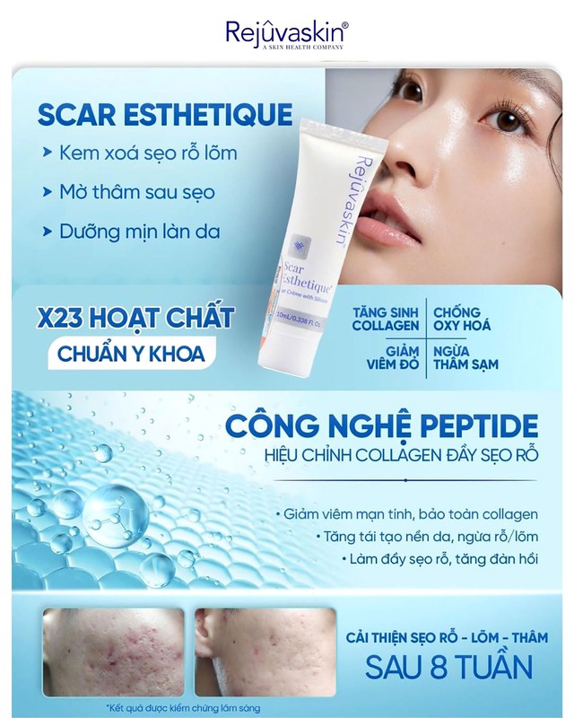 Sẹo mụn h&igrave;nh th&agrave;nh như thế n&agrave;o? Hiểu nguy&ecirc;n nh&acirc;n nắm r&otilde; c&aacute;ch x&oacute;a sẹo hiệu quả- Ảnh 3.