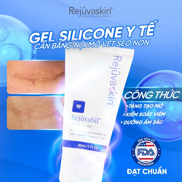 Gel b&ocirc;i vết thương hở n&agrave;o mau l&agrave;nh, hạn chế sẹo tối đa? - Ảnh 8.