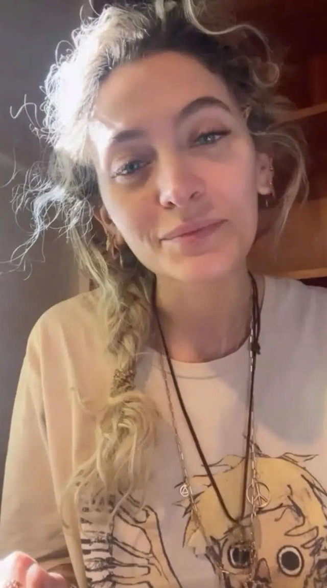 Con g&aacute;i Michael Jackson bị hỏng mũi do lạm dụng ma t&uacute;y  - Ảnh 1.