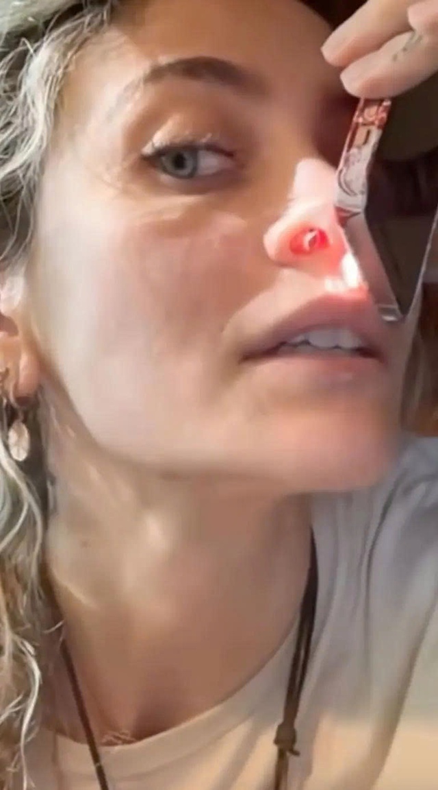 Con g&aacute;i Michael Jackson bị hỏng mũi do lạm dụng ma t&uacute;y  - Ảnh 2.