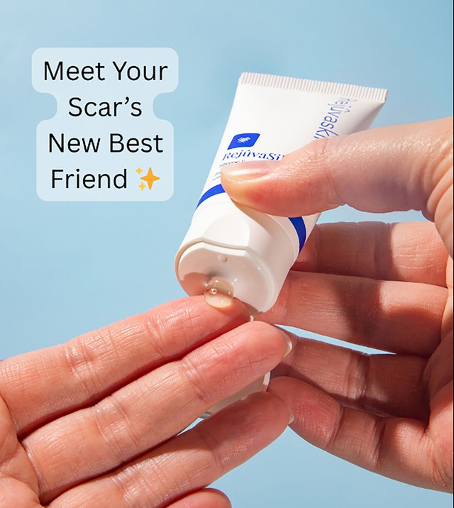 Sử dụng kem mờ sẹo chuẩn y khoa hiệu quả tăng gấp 3 ngừa t&aacute;i ph&aacute;t- Ảnh 1.