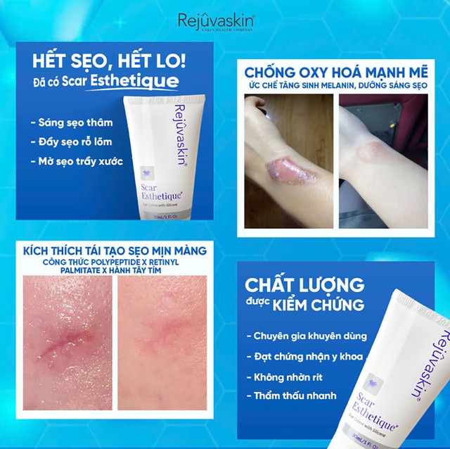 Sử dụng kem mờ sẹo chuẩn y khoa hiệu quả tăng gấp 3 ngừa t&aacute;i ph&aacute;t- Ảnh 5.