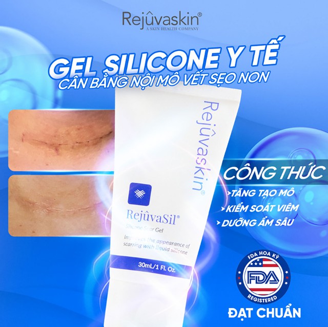 Sử dụng kem mờ sẹo chuẩn y khoa hiệu quả tăng gấp 3 ngừa t&aacute;i ph&aacute;t- Ảnh 7.