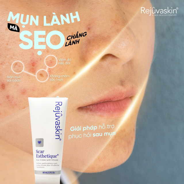 V&igrave; sao Scar Esthetique l&agrave; sản phẩm d&agrave;nh cho th&acirc;m đỏ sau mụn? - Ảnh 3.