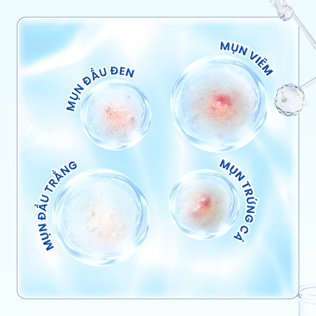 Trioderma - Hành trình thấu hiểu và chăm sóc làn da dầu mụn người Việt- Ảnh 3. Trioderma - Hành trình thấu hiểu và chăm sóc làn da dầu mụn người Việt- Ảnh 3.