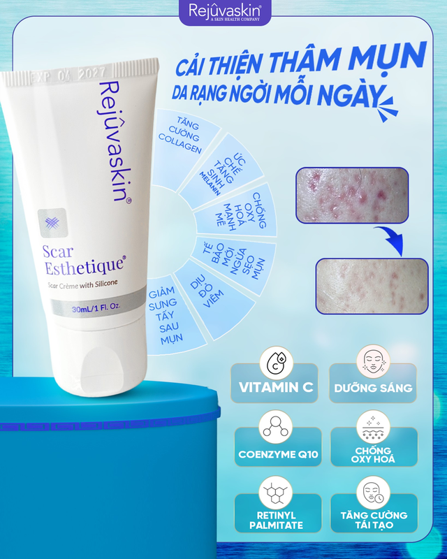 V&igrave; sao Scar Esthetique l&agrave; sản phẩm d&agrave;nh cho th&acirc;m đỏ sau mụn? - Ảnh 4.